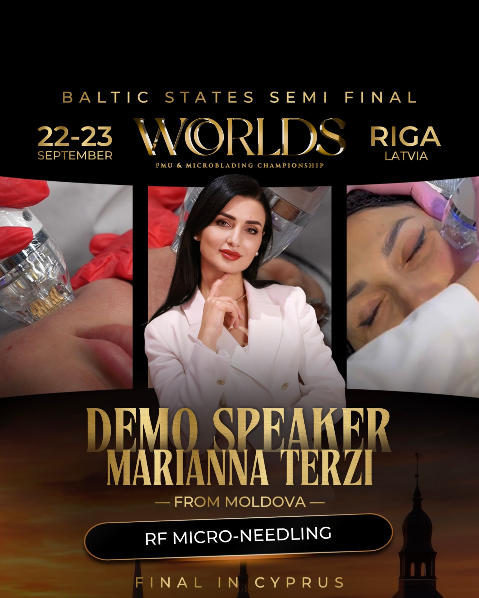Marianna Terzi — RF Micro-Needling